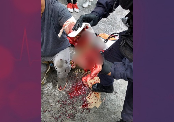 Resultado de imagen para Fingen ser de la CFE pero solo quieren âmachetearteâ