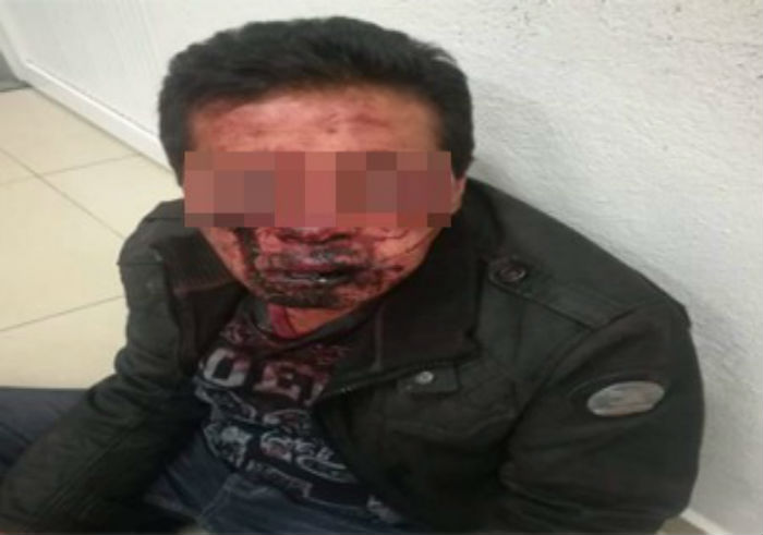 Resultado de imagen para Durante riÃ±a familiar un sujeto fue apuÃ±alado por su primo